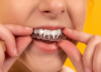 AlignerCo Reviews: A Comprehensive Guide to the Clear Aligner Company