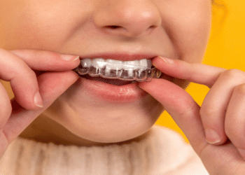 Byte vs Invisalign: Everything You Need To Know About Two Popular Invisible Aligners