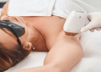 Navigating Laser Hair Removal Understanding Different Skin Types and Treatments