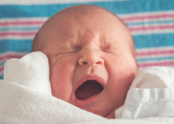 Bye-Bye Bumps! Ways to Get Rid of Milia for Smooth, Flawless Skin