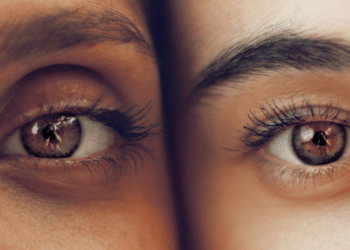 A Guide to Finding Expert Dry Eye Specialists