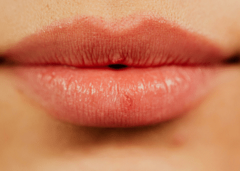 Dermal Fillers Supplier: MayLips' High Quality Injectables