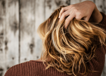 Hair Restoration Choosing the Right Procedure for You _2