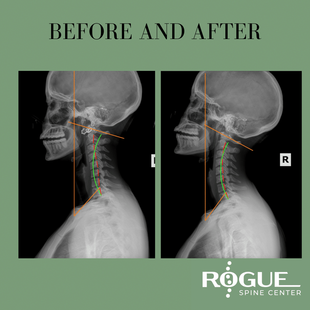 Rogue Chiropractic: Portland’s Premier Chiropractic Care
