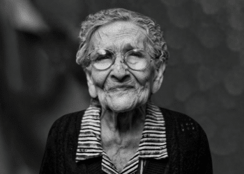 Unlocking the Secrets of Youth: How Collagen Treatment Can Combat Aging and Wrinkles