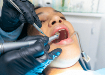 Common Myths About Getting Braces on Crooked Teeth