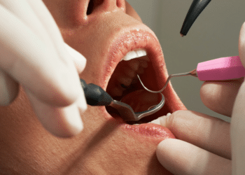 The Reasons You Might Need an Emergency Dentist