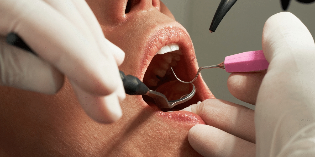 The Reasons You Might Need an Emergency Dentist