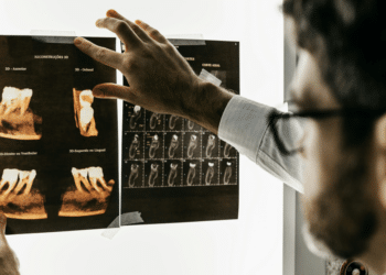 Understanding Signs of Wisdom Teeth and How to Spot Them