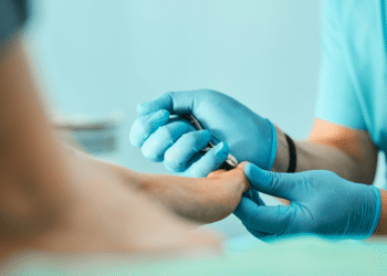How Do You Treat and Prevent Ingrown Toenails