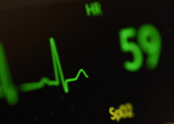 Every Beat Matters Frontier X2, Your Daily Heart Rate Monitor