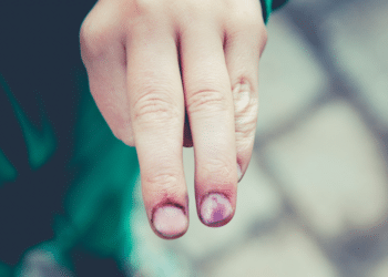 How Lawyers Can Strengthen Your Personal Injury Claim in Chicago?