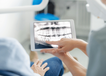 Why Choose Mega Dental Willow Grove for Your Dental Needs?