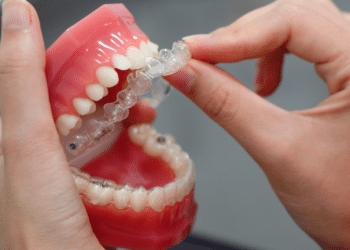 The Pros and Cons of Various Types of Dentures and Partials