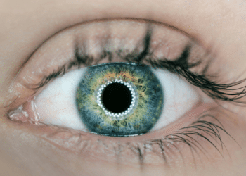 Who Is A Candidate For Laser Eye Surgery? Age And Health Factors_2