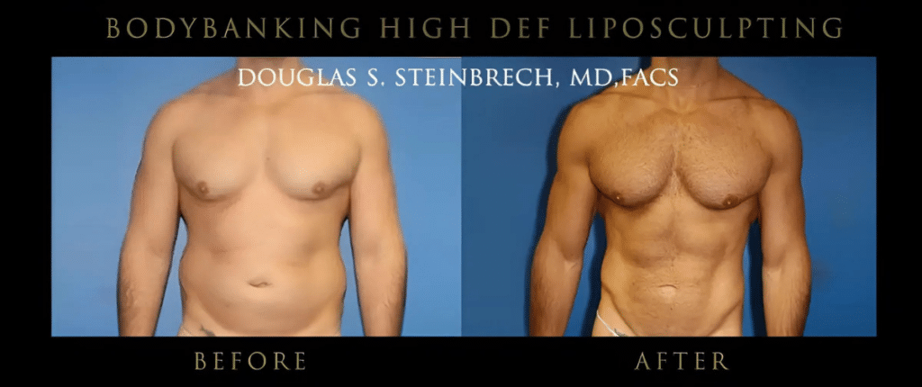 Dr. Douglas S. Steinbrech: Pioneering the Rise of Male Plastic Surgery