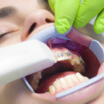 Gum Disease Treatment - Restoring Oral Health