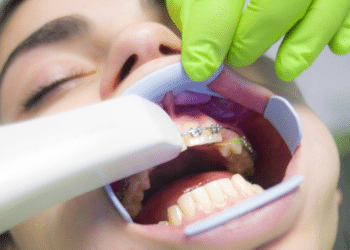 Gum Disease Treatment - Restoring Oral Health