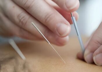 How to Treat Chronic Back Pain Without Surgery