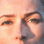 How to Treat Glabellar Lines: A Comprehensive Guide to Modern Treatments