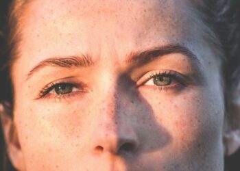 How to Treat Glabellar Lines: A Comprehensive Guide to Modern Treatments