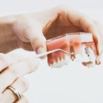 5 Tips For Caring For Your Dental Implant Crowns