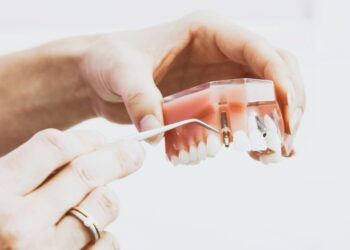 5 Tips For Caring For Your Dental Implant Crowns