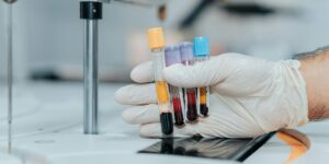 Centrifuge Tube Explained: Types, Sizes & Proper Usage