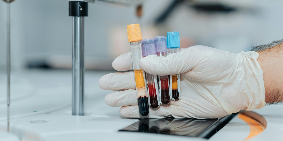 Centrifuge Tube Explained: Types, Sizes & Proper Usage