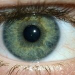 When to Visit Ocular Aesthetics in Melbourne
