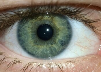 When to Visit Ocular Aesthetics in Melbourne