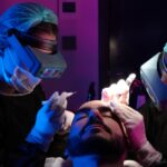 Hair Transplant in Istanbul - Here’s What You Should Know!