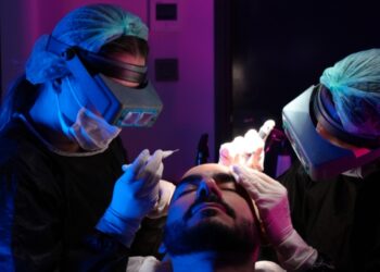 Hair Transplant in Istanbul - Here’s What You Should Know!