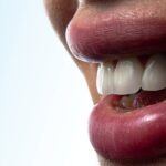Dental Implants: The Gold Standard for Permanent Tooth Replacement