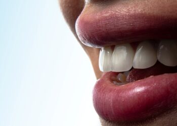Dental Implants: The Gold Standard for Permanent Tooth Replacement