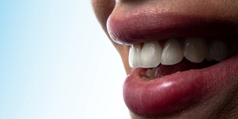 Dental Implants: The Gold Standard for Permanent Tooth Replacement