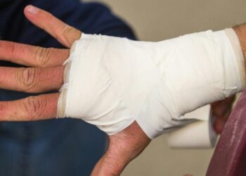 Exploring Legal Options for Personal Injury Claims in Charlotte