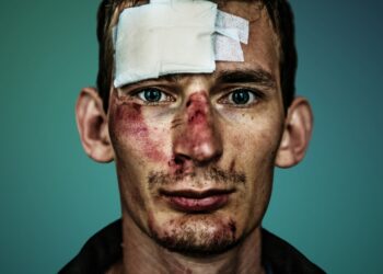 Baltimore Personal Injuries: Protecting Your Rights and Recovery