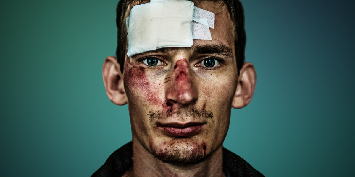 Baltimore Personal Injuries: Protecting Your Rights and Recovery