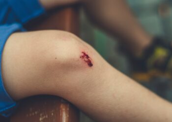 What Damages You Can Recover in a Personal Injury Case