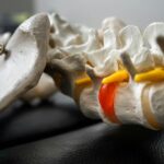 Non-Surgical Treatment Options for Disc and Nerve Pain