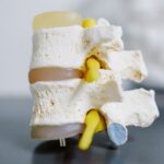 Non-Surgical Disc Care at ReliefNow Laser Charlotte