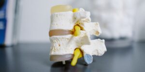 Non-Surgical Disc Care at ReliefNow Laser Charlotte