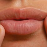 Not Just Lips New York: How Personalized Aesthetic Consultations Create Better Results