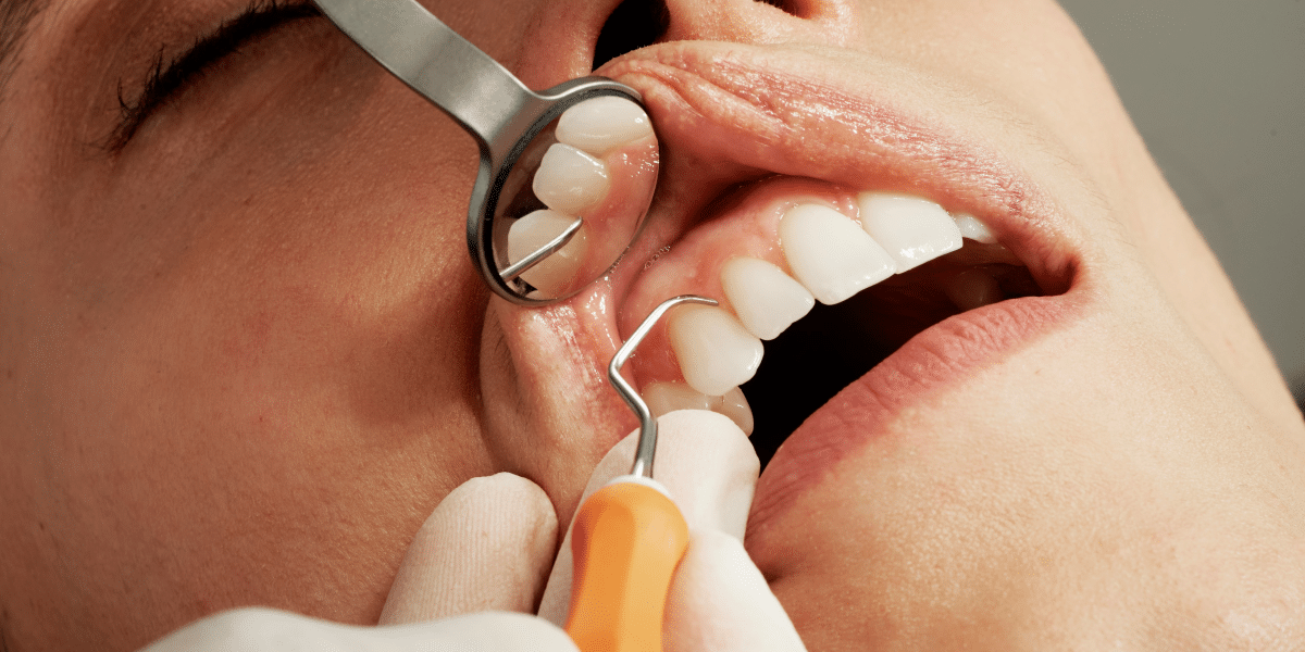 Benefits of Private Dentistry in St John’s Wood