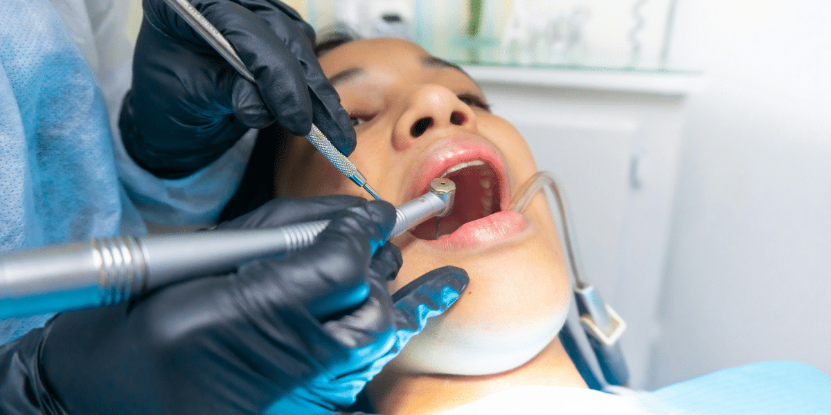 Common Myths About Getting Braces on Crooked Teeth