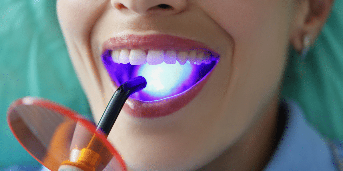 Expert Tips for Finding the Right Professional Teeth Whitening Equipment for Your Dental Practice