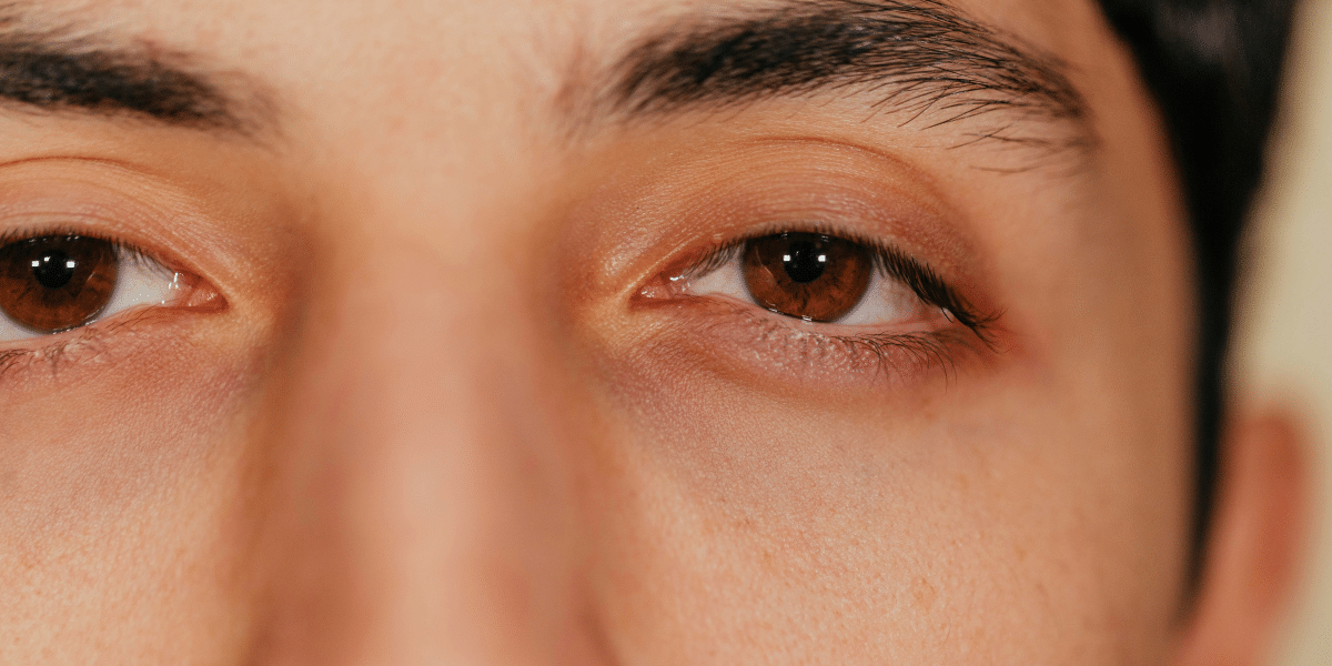 The Benefits and Considerations of Double Eyelid Surgery