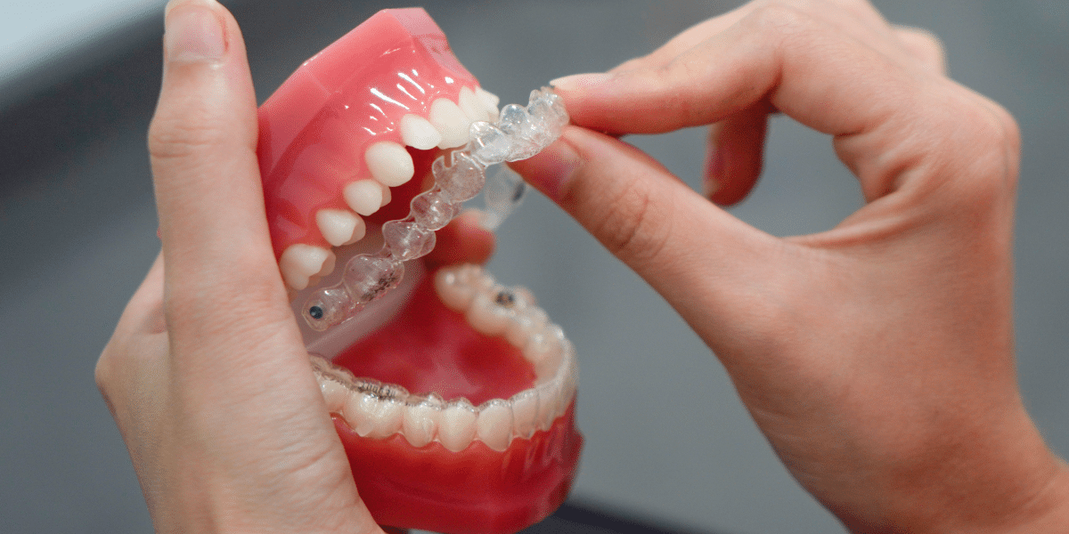 The Pros and Cons of Various Types of Dentures and Partials