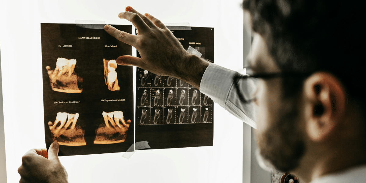 Understanding Signs of Wisdom Teeth and How to Spot Them